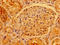 Acetoacetyl-CoA Synthetase antibody, LS-C674114, Lifespan Biosciences, Immunohistochemistry paraffin image 