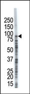 Ubiquitin Specific Peptidase 10 antibody, AP12020PU-N, Origene, Western Blot image 