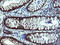 Tubulin Folding Cofactor C antibody, LS-C173937, Lifespan Biosciences, Immunohistochemistry paraffin image 