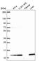 Transmembrane Protein 256 antibody, HPA062732, Atlas Antibodies, Western Blot image 