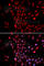 Karyopherin Subunit Alpha 4 antibody, A2026, ABclonal Technology, Immunofluorescence image 