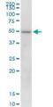 Potassium Channel Tetramerization Domain Containing 18 antibody, H00130535-B01P, Novus Biologicals, Western Blot image 