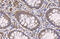 Phosphatase And Tensin Homolog antibody, GTX101025, GeneTex, Immunohistochemistry paraffin image 