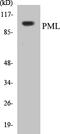 Promyelocytic Leukemia antibody, EKC1477, Boster Biological Technology, Western Blot image 