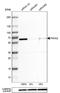 Prolyl 4-Hydroxylase Subunit Alpha 2 antibody, NBP2-52922, Novus Biologicals, Western Blot image 