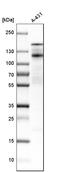 Desmoglein 2 antibody, HPA004896, Atlas Antibodies, Western Blot image 