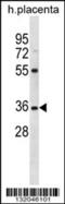 Olfactory Receptor Family 5 Subfamily AN Member 1 antibody, 56-531, ProSci, Western Blot image 
