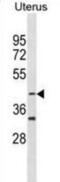 Colony Stimulating Factor 2 Receptor Alpha Subunit antibody, abx031052, Abbexa, Western Blot image 