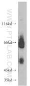 CD320 Molecule antibody, 10343-1-AP, Proteintech Group, Western Blot image 