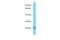 DnaJ Heat Shock Protein Family (Hsp40) Member C12 antibody, PA5-70328, Invitrogen Antibodies, Western Blot image 