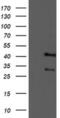 Tropomodulin-1 antibody, MA5-25612, Invitrogen Antibodies, Western Blot image 