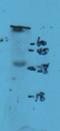 Natural Cytotoxicity Triggering Receptor 2 antibody, GTX37443, GeneTex, Western Blot image 