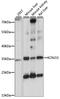 Potassium Voltage-Gated Channel Subfamily J Member 15 antibody, A15282, ABclonal Technology, Western Blot image 