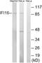 Interferon Gamma Inducible Protein 16 antibody, A30690, Boster Biological Technology, Western Blot image 