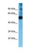 Transmembrane Serine Protease 11F antibody, orb331399, Biorbyt, Western Blot image 