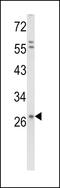 Syndecan 1 antibody, 61-618, ProSci, Western Blot image 