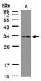 NSL1 Component Of MIS12 Kinetochore Complex antibody, PA5-21571, Invitrogen Antibodies, Western Blot image 