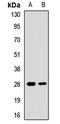 Eukaryotic Translation Initiation Factor 4E Family Member 2 antibody, LS-C668329, Lifespan Biosciences, Western Blot image 