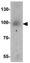 Phosphatidylinositol 3-Kinase Catalytic Subunit Type 3 antibody, GTX31583, GeneTex, Western Blot image 