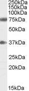 Neuregulin 3 antibody, PA5-18552, Invitrogen Antibodies, Western Blot image 