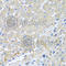 Pro-Platelet Basic Protein antibody, A1925, ABclonal Technology, Immunohistochemistry paraffin image 