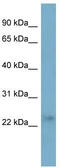 Ferritin Heavy Chain Like 17 antibody, TA339589, Origene, Western Blot image 