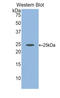 Fibulin 2 antibody, LS-C293928, Lifespan Biosciences, Western Blot image 