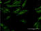 Interferon Gamma Receptor 2 antibody, LS-C197500, Lifespan Biosciences, Immunofluorescence image 
