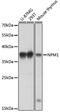 Nucleophosmin 1 antibody, 18-178, ProSci, Western Blot image 