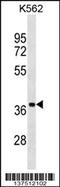 Ubiquitin Like Domain Containing CTD Phosphatase 1 antibody, 59-232, ProSci, Western Blot image 