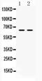 Heterogeneous Nuclear Ribonucleoprotein L antibody, PA5-79383, Invitrogen Antibodies, Western Blot image 