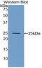 TIMP Metallopeptidase Inhibitor 3 antibody, LS-C296676, Lifespan Biosciences, Western Blot image 