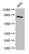 Carnitine Palmitoyltransferase 1B antibody, CSB-PA821674LA01HU, Cusabio, Western Blot image 