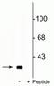 Protein Phosphatase 1 Regulatory Inhibitor Subunit 1B antibody, P03424, Boster Biological Technology, Western Blot image 