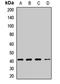 Cystinosin, Lysosomal Cystine Transporter antibody, LS-C668168, Lifespan Biosciences, Western Blot image 