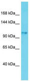 SKI/DACH domain-containing protein 1  antibody, TA334883, Origene, Western Blot image 