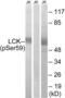 LCK Proto-Oncogene, Src Family Tyrosine Kinase antibody, LS-C199193, Lifespan Biosciences, Western Blot image 