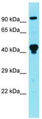 La Ribonucleoprotein Domain Family Member 4B antibody, TA343825, Origene, Western Blot image 