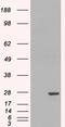 Glutathione S-Transferase Pi 1 antibody, LS-B2376, Lifespan Biosciences, Western Blot image 