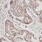 Periostin antibody, FNab06315, FineTest, Immunohistochemistry paraffin image 