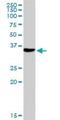 Nudix Hydrolase 6 antibody, H00011162-D01P, Novus Biologicals, Western Blot image 