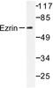 Ezrin antibody, LS-C176015, Lifespan Biosciences, Western Blot image 