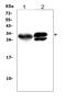 Kallikrein 1 antibody, PA1709, Boster Biological Technology, Western Blot image 