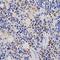 Proteasome 26S Subunit, Non-ATPase 3 antibody, GTX33430, GeneTex, Immunohistochemistry paraffin image 