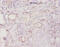 Ro60, Y RNA Binding Protein antibody, CSB-PA13749A0Rb, Cusabio, Immunohistochemistry paraffin image 