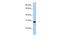 Antagonist Of Mitotic Exit Network 1 Homolog antibody, PA5-44186, Invitrogen Antibodies, Western Blot image 