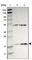 Apolipoprotein O antibody, HPA003187, Atlas Antibodies, Western Blot image 