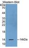 Olfactomedin 4 antibody, LS-C295710, Lifespan Biosciences, Western Blot image 