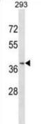 C-C Motif Chemokine Receptor Like 2 antibody, abx028870, Abbexa, Western Blot image 