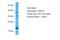 Thioredoxin domain-containing protein 8 antibody, A13008, Boster Biological Technology, Western Blot image 